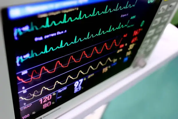 Patient Monitor